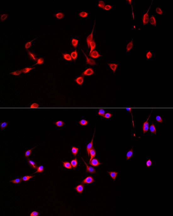 Monoacylglycerol Lipase Antibody in Immunocytochemistry (ICC/IF)