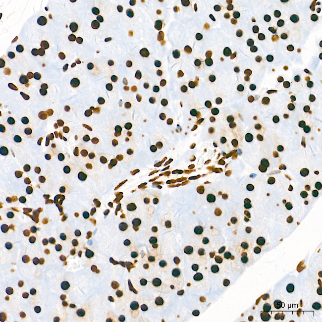 H4K16ac Antibody in Immunohistochemistry (Paraffin) (IHC (P))