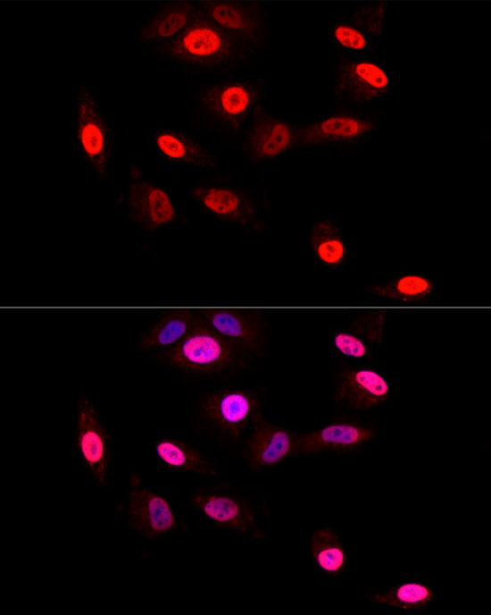 GLI2 Antibody in Immunocytochemistry (ICC/IF)