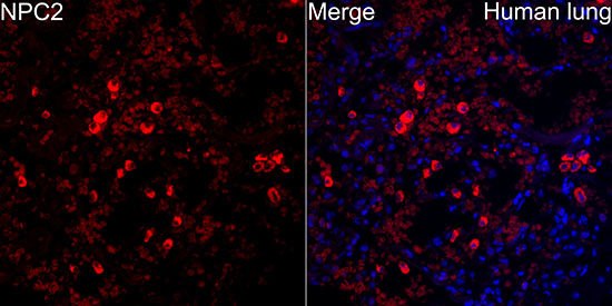 NPC2 Antibody in Immunohistochemistry (Paraffin) (IHC (P))