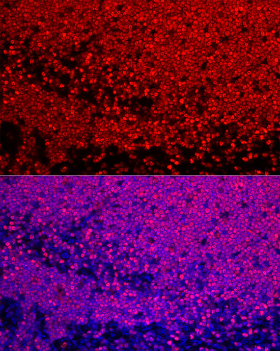 SATB1 Antibody in Immunohistochemistry (Paraffin) (IHC (P))