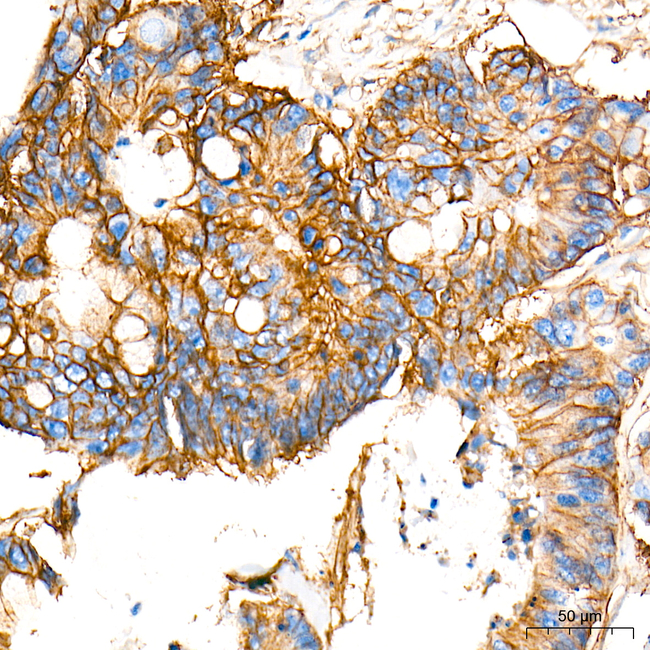 ASCT2 Antibody in Immunohistochemistry (Paraffin) (IHC (P))