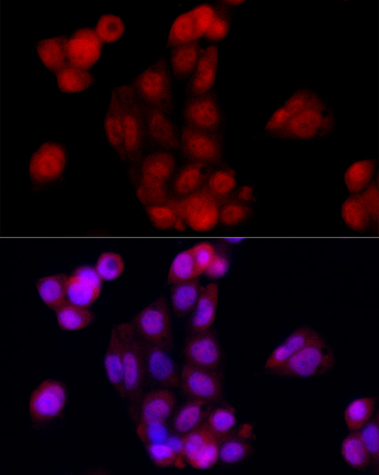 S100A1 Antibody in Immunocytochemistry (ICC/IF)