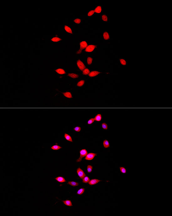 FGF1 Antibody in Immunocytochemistry (ICC/IF)