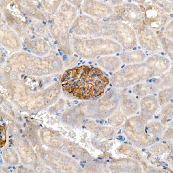 Nephrin Antibody in Immunohistochemistry (Paraffin) (IHC (P))