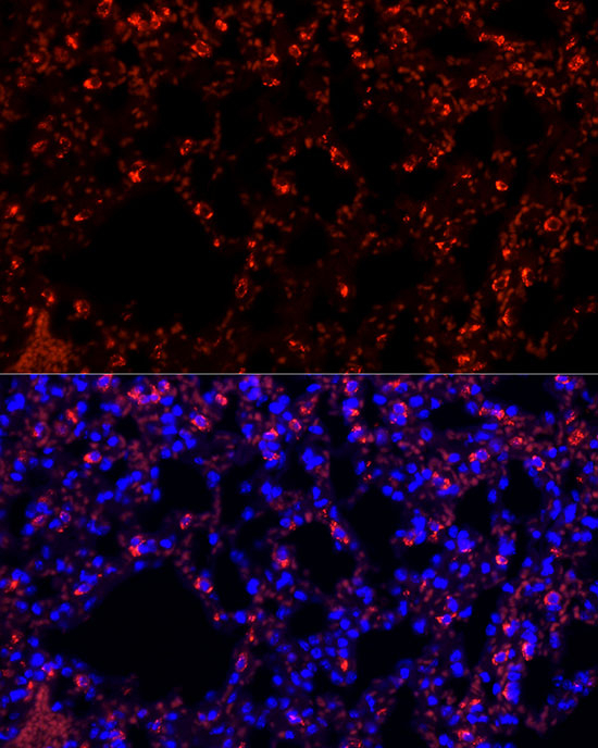 SFTPC Antibody in Immunohistochemistry (Paraffin) (IHC (P))