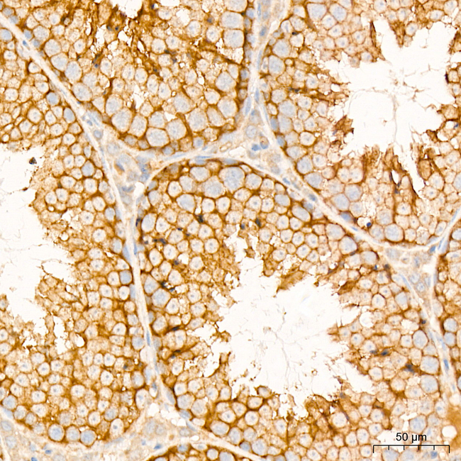 NF2 Antibody in Immunohistochemistry (Paraffin) (IHC (P))