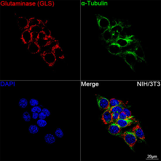 Glutaminase Antibody in Immunocytochemistry (ICC/IF)