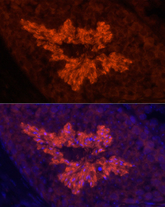 ATP1A4 Antibody in Immunohistochemistry (Paraffin) (IHC (P))