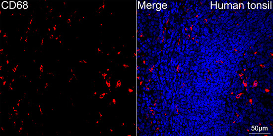 CD68 Antibody in Immunohistochemistry (Paraffin) (IHC (P))