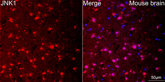 JNK1 Antibody in Immunohistochemistry (Paraffin) (IHC (P))