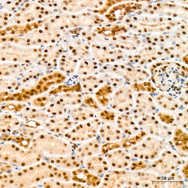 KPNB1 Antibody in Immunohistochemistry (Paraffin) (IHC (P))