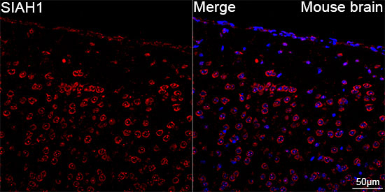 SIAH1 Antibody in Immunohistochemistry (Paraffin) (IHC (P))