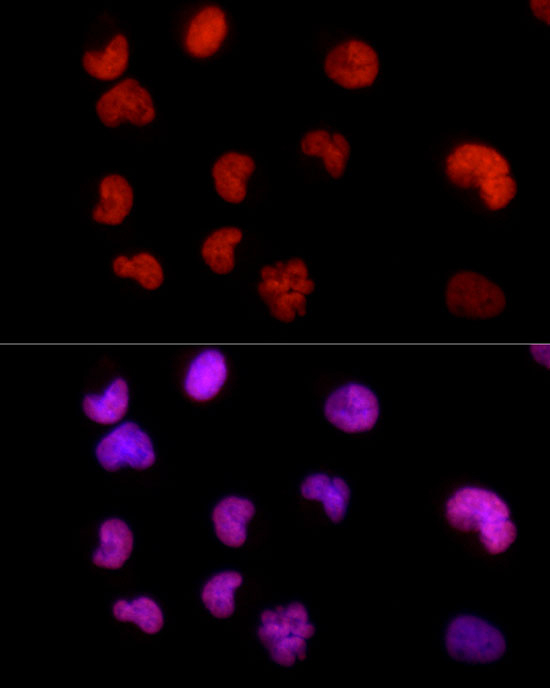 hnRNP D Antibody in Immunocytochemistry (ICC/IF)