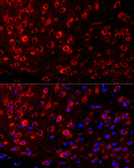 FABP7 Antibody in Immunohistochemistry (Paraffin) (IHC (P))