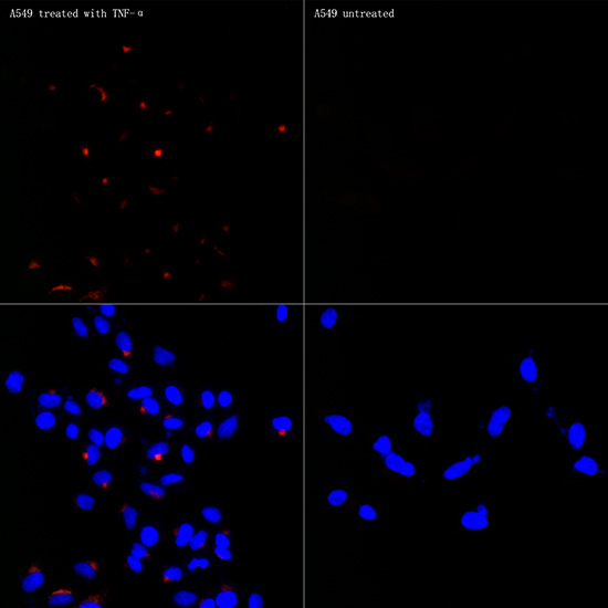 CCL2 Antibody in Immunocytochemistry (ICC/IF)