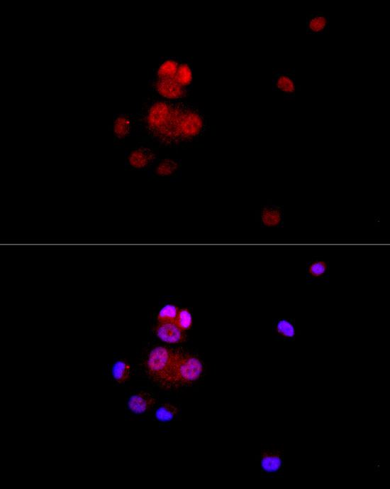 VDR Antibody in Immunocytochemistry (ICC/IF)