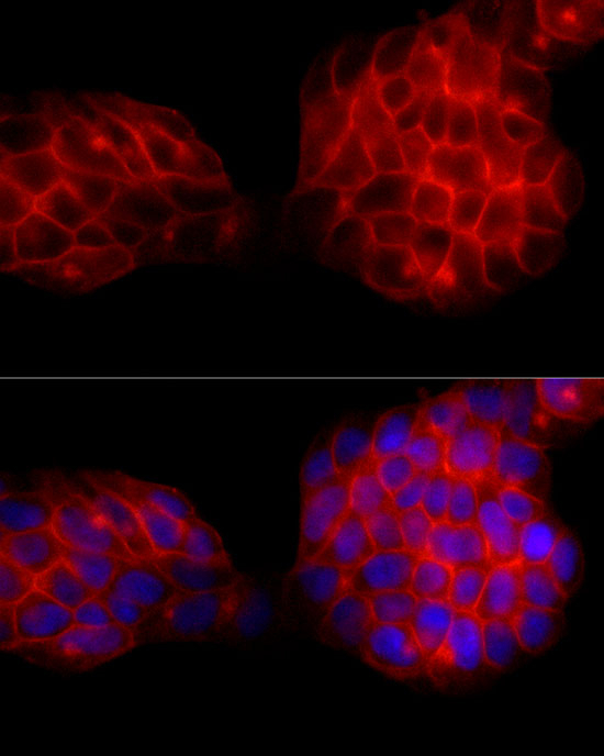 SLC14A1 Antibody in Immunocytochemistry (ICC/IF)