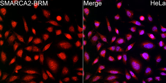 SMARCA2 Antibody in Immunocytochemistry (ICC/IF)
