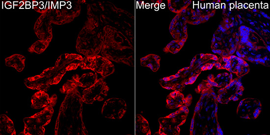 IGF2BP3 Antibody in Immunohistochemistry (Paraffin) (IHC (P))