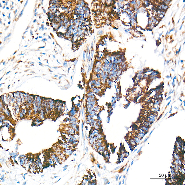 Cathepsin L Antibody in Immunohistochemistry (Paraffin) (IHC (P))