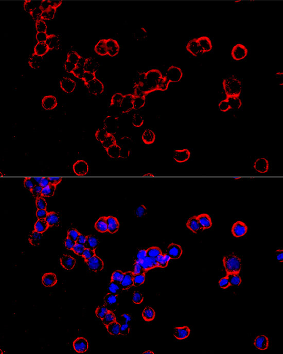 SLC11A2 Antibody in Immunocytochemistry (ICC/IF)