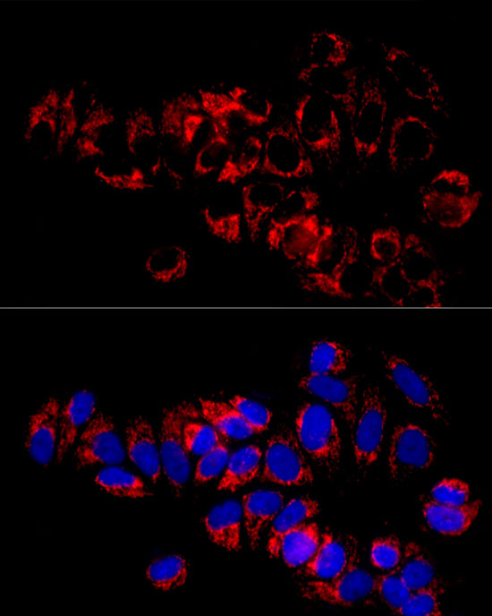 SLC25A5 Antibody in Immunocytochemistry (ICC/IF)