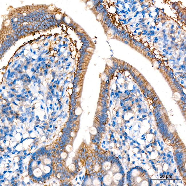 SMPD3 Antibody in Immunohistochemistry (Paraffin) (IHC (P))