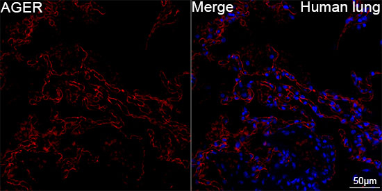 RAGE Antibody in Immunohistochemistry (Paraffin) (IHC (P))