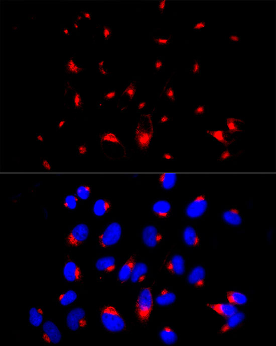 beta-2 Microglobulin Antibody in Immunocytochemistry (ICC/IF)