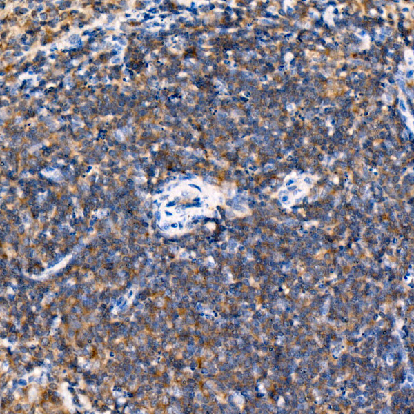 USP25 Antibody in Immunohistochemistry (Paraffin) (IHC (P))