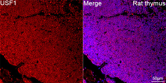 USF1 Antibody in Immunohistochemistry (Paraffin) (IHC (P))