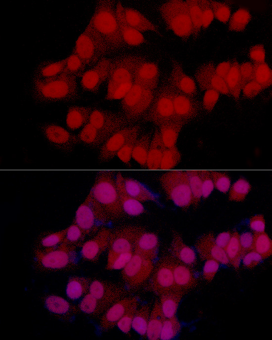 MGMT Antibody in Immunocytochemistry (ICC/IF)