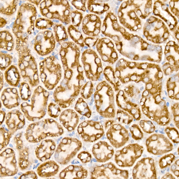 Mitofilin Antibody in Immunohistochemistry (Paraffin) (IHC (P))