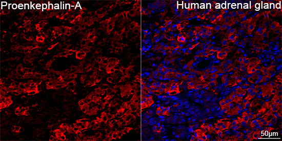 PENK Antibody in Immunohistochemistry (Paraffin) (IHC (P))