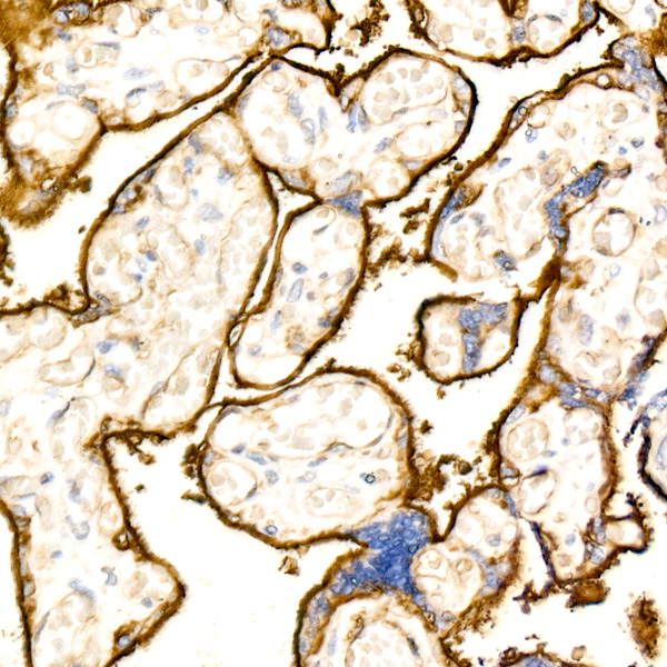 CD200 Antibody in Immunohistochemistry (Paraffin) (IHC (P))