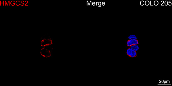 HMGCS2 Antibody in Immunocytochemistry (ICC/IF)
