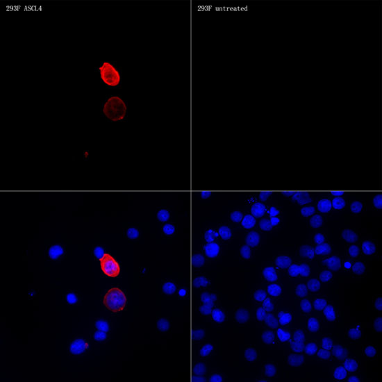 ASCL4 Antibody in Immunocytochemistry (ICC/IF)