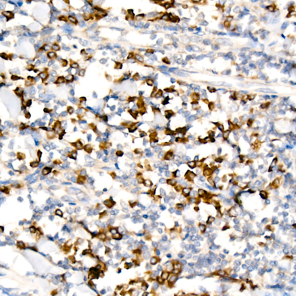 WNK3 Antibody in Immunohistochemistry (Paraffin) (IHC (P))