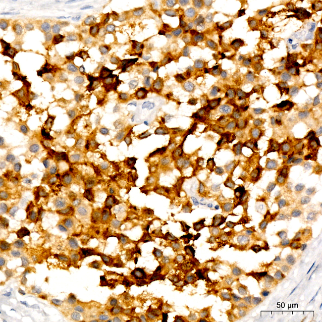 PMEL Antibody in Immunohistochemistry (Paraffin) (IHC (P))