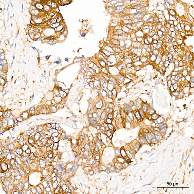 PFKL Antibody in Immunohistochemistry (Paraffin) (IHC (P))