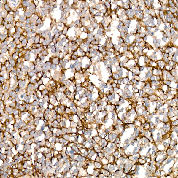 VCAM1 Antibody in Immunohistochemistry (Paraffin) (IHC (P))