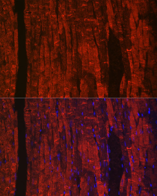 Phospholamban Antibody in Immunohistochemistry (Paraffin) (IHC (P))