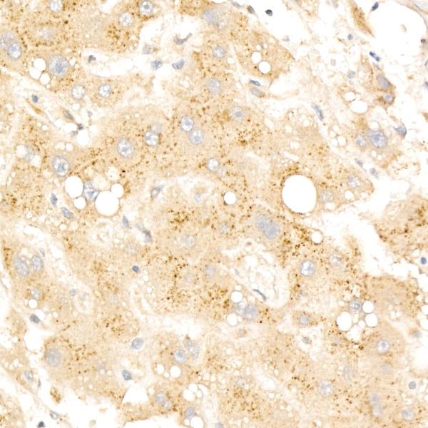 beta Galactosidase Antibody in Immunohistochemistry (Paraffin) (IHC (P))