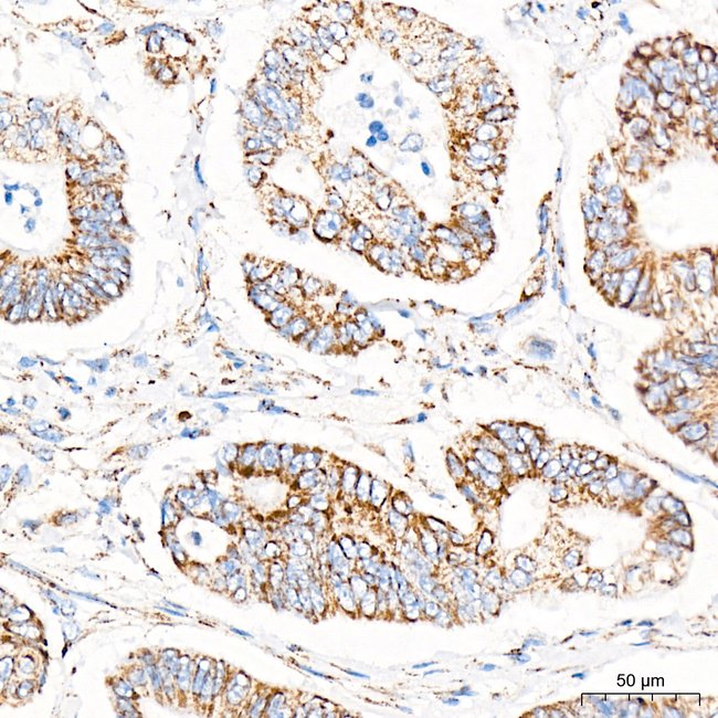 SLC25A13 Antibody in Immunohistochemistry (Paraffin) (IHC (P))