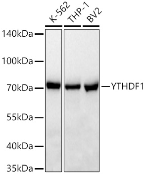 YTHDF1 Antibody in Western Blot (WB)
