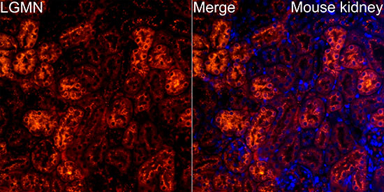 LGMN Antibody in Immunohistochemistry (Paraffin) (IHC (P))