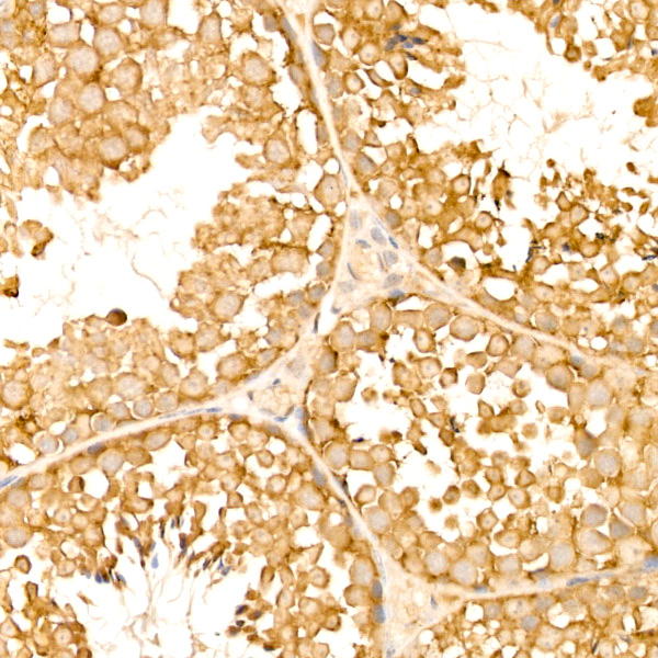 TOLLIP Antibody in Immunohistochemistry (Paraffin) (IHC (P))