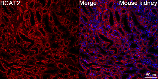 BCAT2 Antibody in Immunohistochemistry (Paraffin) (IHC (P))