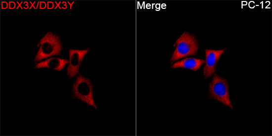 DDX3/DDX3Y Antibody in Immunocytochemistry (ICC/IF)